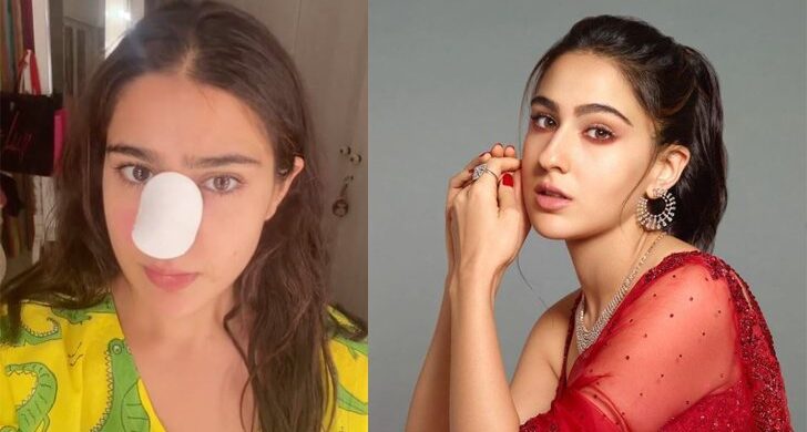 নাক কেটে রক্তাক্ত সারা আলী!