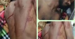 জুরাইনে কিশোর গ্যাংয়ের হামলা: যুবক মৃত্যুর সঙ্গে লড়ছেন, পুলিশের তদন্ত চলছে