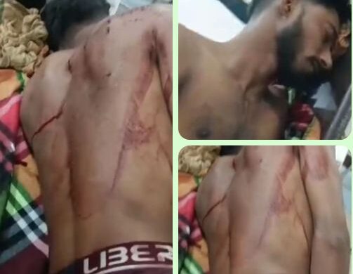 জুরাইনে কিশোর গ্যাংয়ের হামলা: যুবক মৃত্যুর সঙ্গে লড়ছেন, পুলিশের তদন্ত চলছে